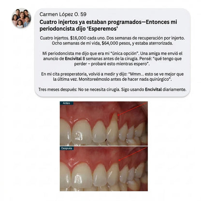 CollaGum - Recupera tus encías y tu sonrisa en 21 días