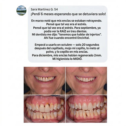 CollaGum - Recupera tus encías y tu sonrisa en 21 días