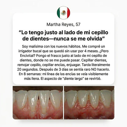 CollaGum - Recupera tus encías y tu sonrisa en 21 días